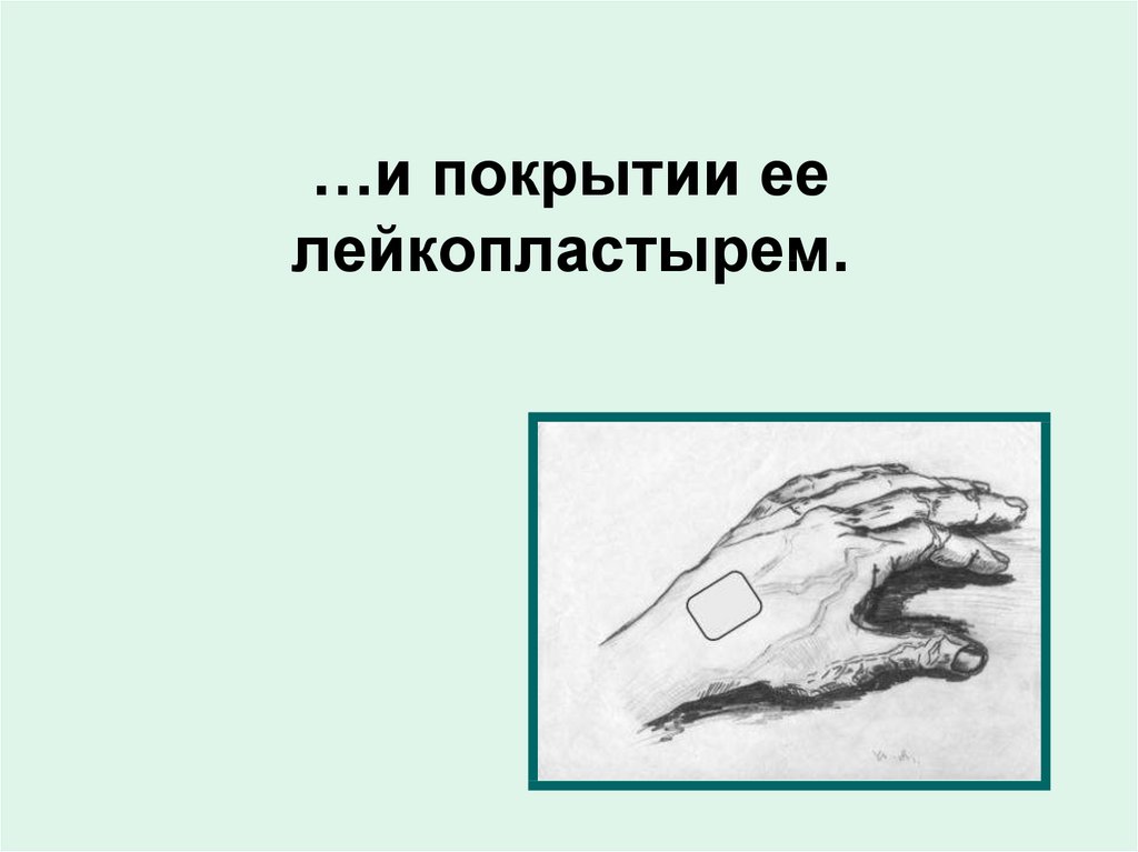 …и покрытии ее лейкопластырем.