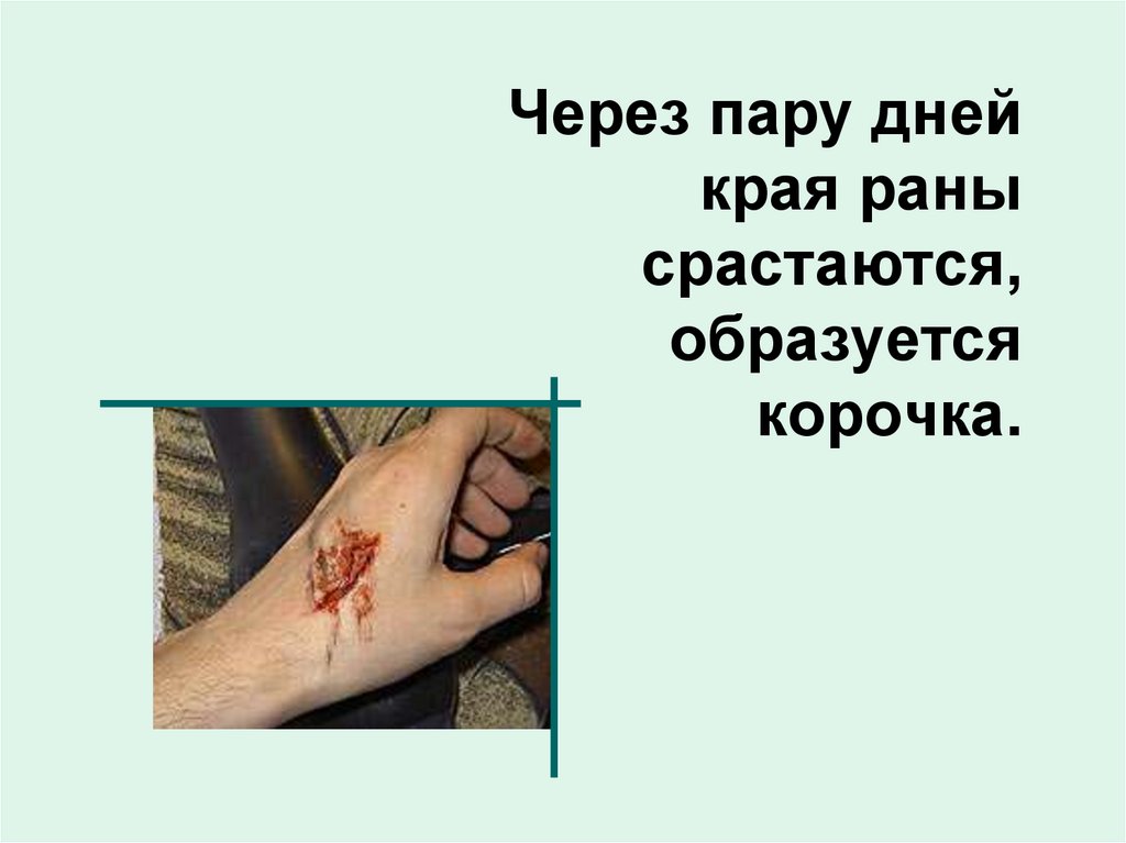 Через пару дней края раны срастаются, образуется корочка.