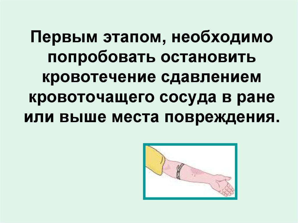 Первым этапом, необходимо попробовать остановить кровотечение сдавлением кровоточащего сосуда в ране или выше места