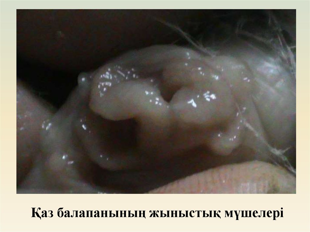 Қаз балапанының жыныстық мүшелері