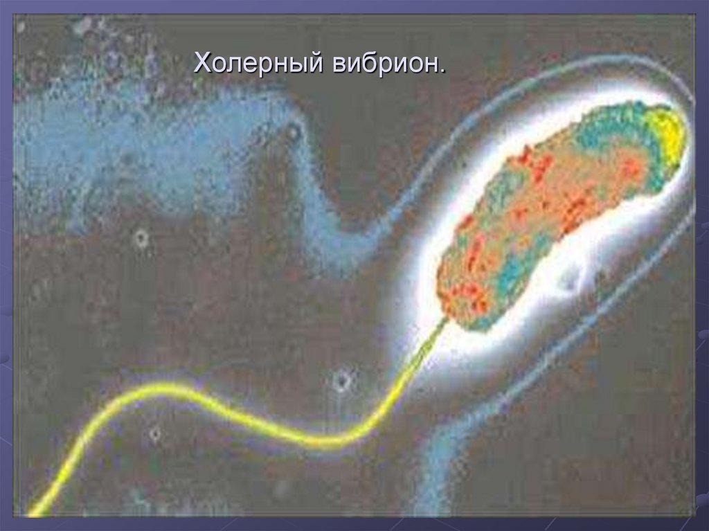 Заражение воды холерой в россии 2024