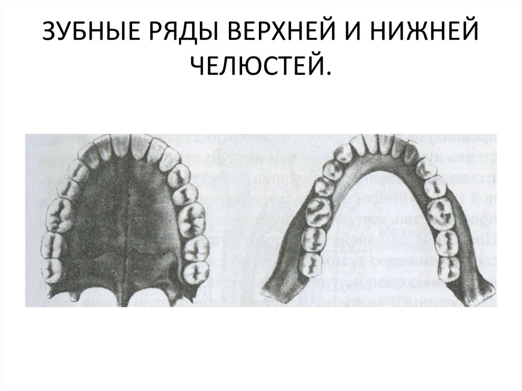 Схема верхней челюсти