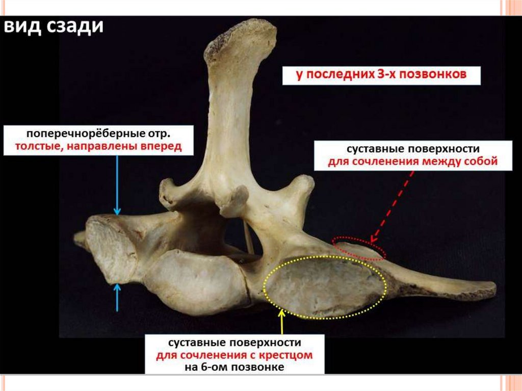 Позвонки животных. Суставные поверхности позвонков. Диафрагмальный позвонок у животных. Строение грудного позвонка животных. Позвонок ската.