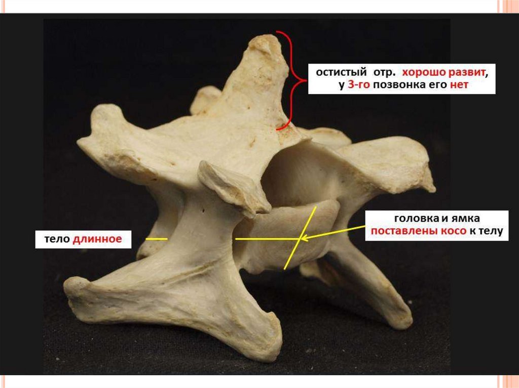 6 шейный позвонок. Атлант позвонок анатомия животных. Типичный шейный позвонок КРС. Шестой шейный позвонок КРС. Седьмой шейный позвонок животных анатомия.