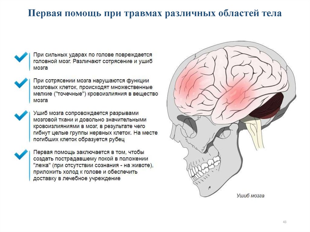 Помощь при травмах. Первая помощь при травмах различных областей тела. Травмы различных областей тела первая помощь. Первач помощь при травм различных областей тела. Первая помощь при травмах различных областей тела кратко.