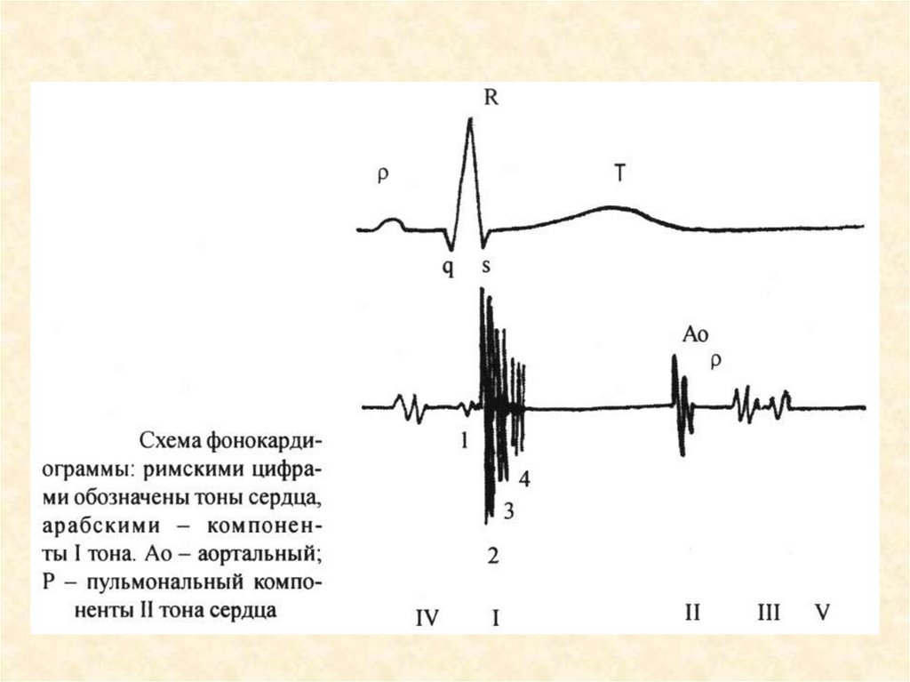 Схема тоны сердца