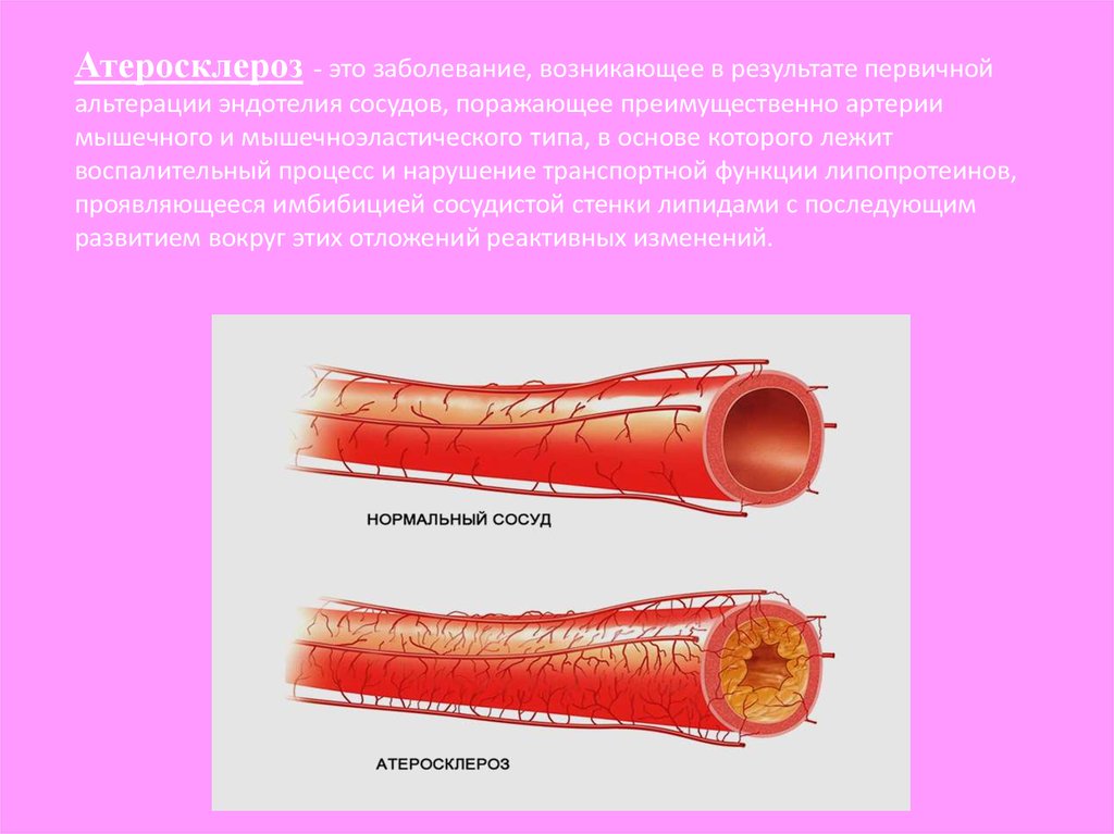 Срез сосуда. Артерия Вена капилляр эндотелий. Эндотелий кровеносных сосудов. Капилляры эндотелия сосудов.