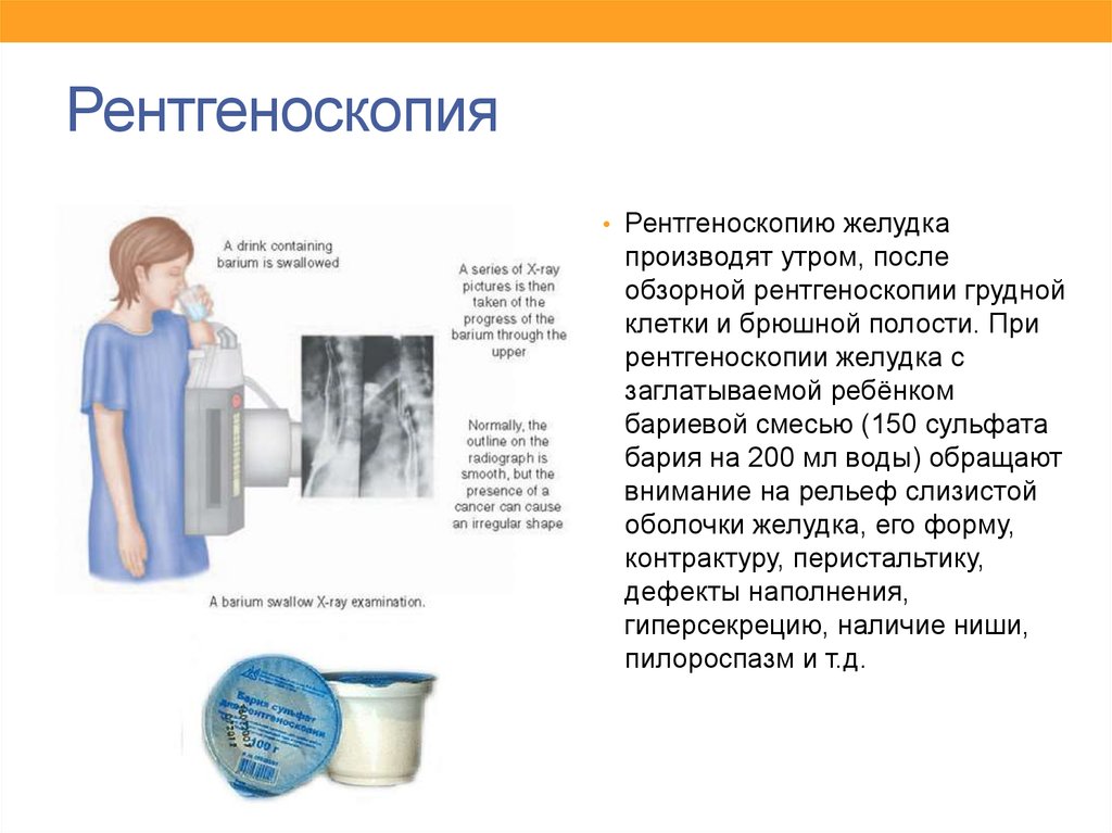 Пить барий рентген. Рентгеноскопия желудка показания. Подготовка к рентгеноскопии желудка. Рентгеноскопия желудка алгоритм проведения. Рентген желудка алгоритм.