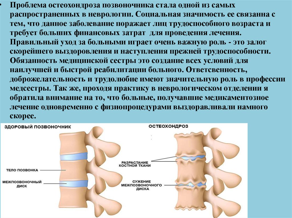 Остеохондроз поясничного отдела позвоночника карта вызова локальный статус