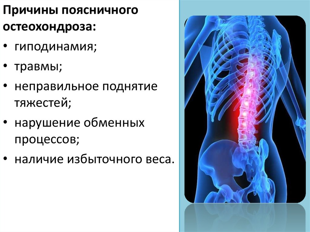 Шейный остеохондроз фото больных