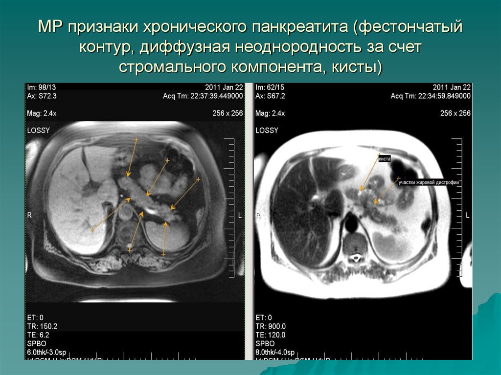 Мр признаки