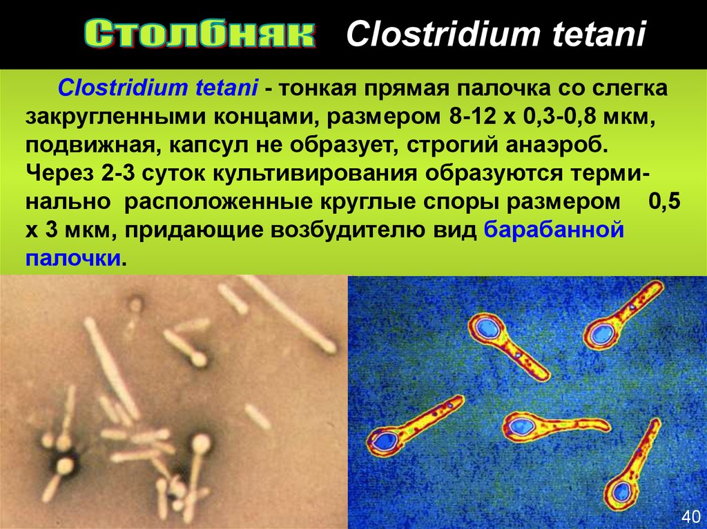 Clostridium spp