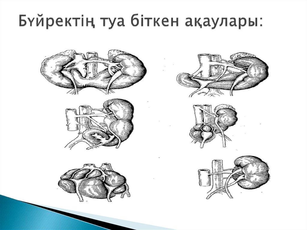 Туа біткен