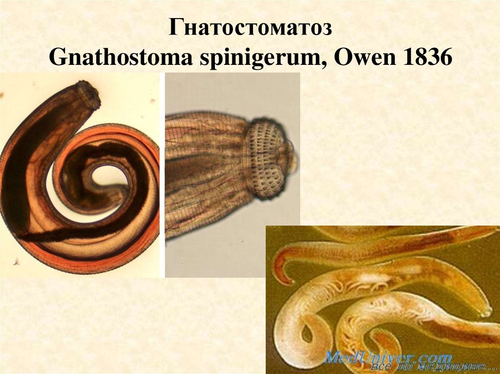 Паразит прудовика. Нематоды Gnathostoma spinigerum, Gnathostoma hispidum..