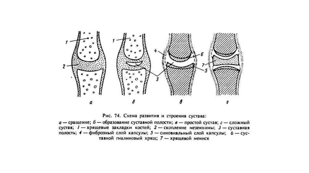 Классификация суставов схема