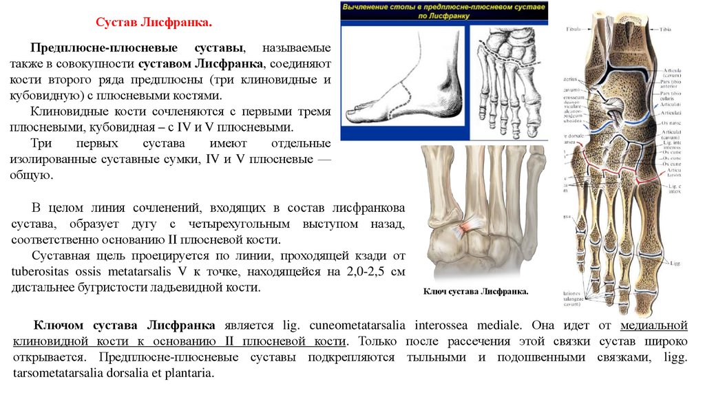 Ампутация по шопару схема