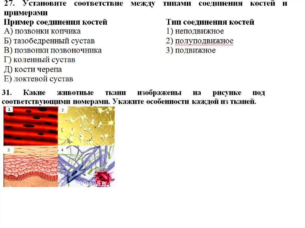 Строение и функции скелетных мышц. Волокна скелетных мышц под микроскопом (?). Их. Длина волокон скелетных мышц под микроскопом. Совокупность клеток образующих ткань мышц внутренних. Волокна сердечной мышечной длину.