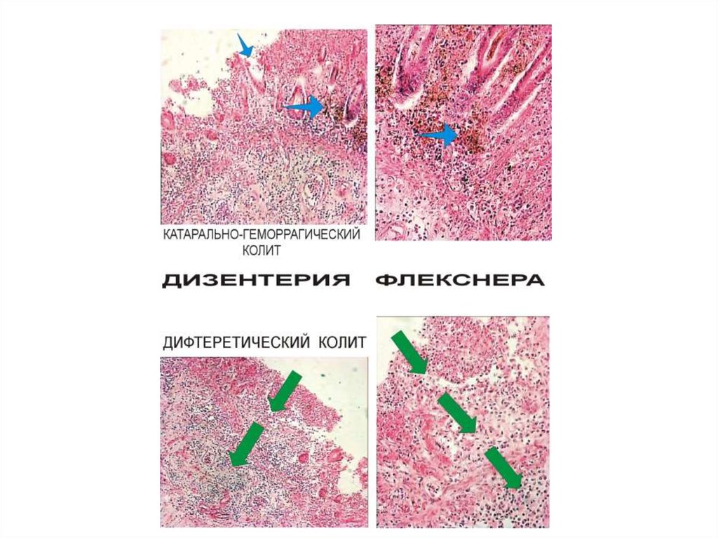 Патологическая анатомия презентации