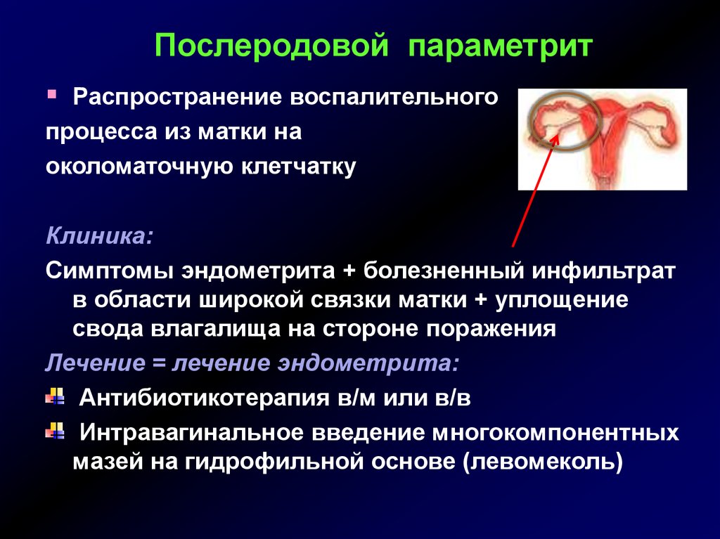 Воспаление болезни. Послеродовой параметрит. Параметрит это воспаление околоматочной клетчатки. Параметрит клиника. Воспалительный процесс в матке.