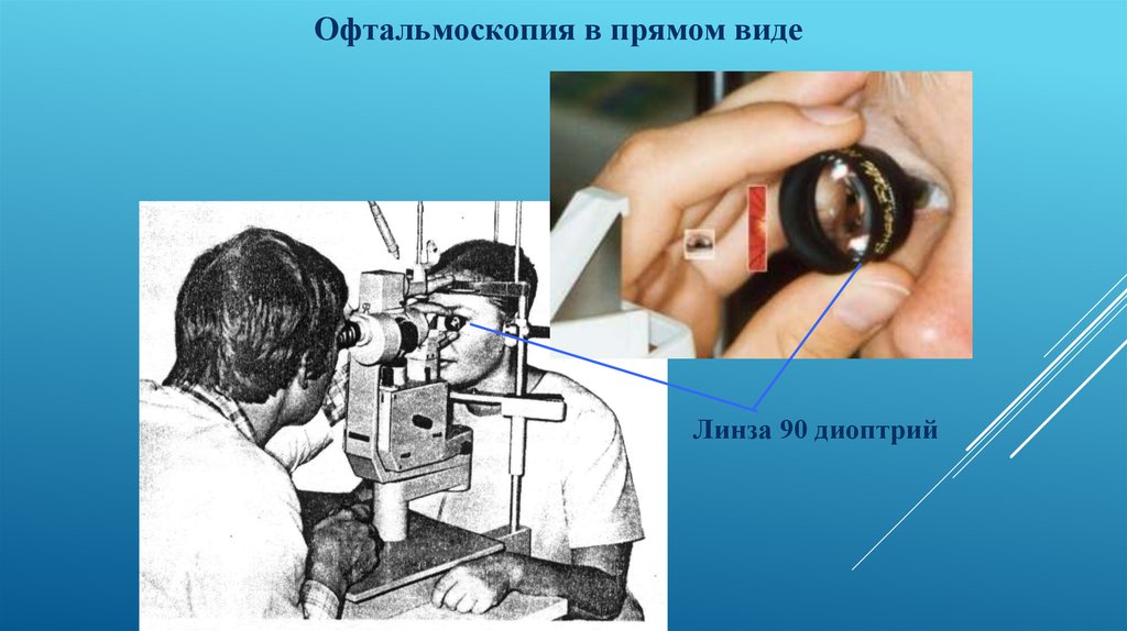 Офтальмоскопия линзой. Лазерный прибор офтальмоскопия. Офтальмолог презентация. Офтальмоскопия в различных спектральных. Прямая офтальмоскопия.
