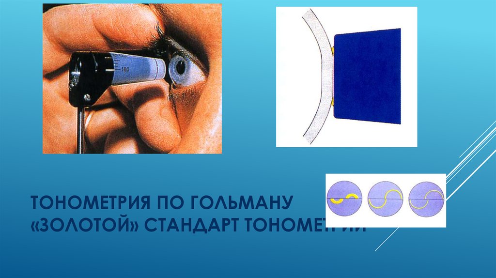 Краска для тонометрии. Тонометрия Гольдмана. Тонометрия презентация. Тонометрия в офтальмологии. Глазная тонометрия показатели.