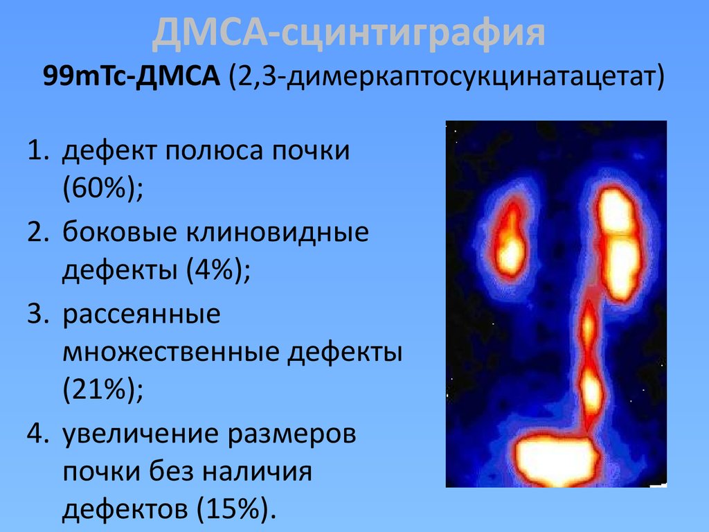 Ренография