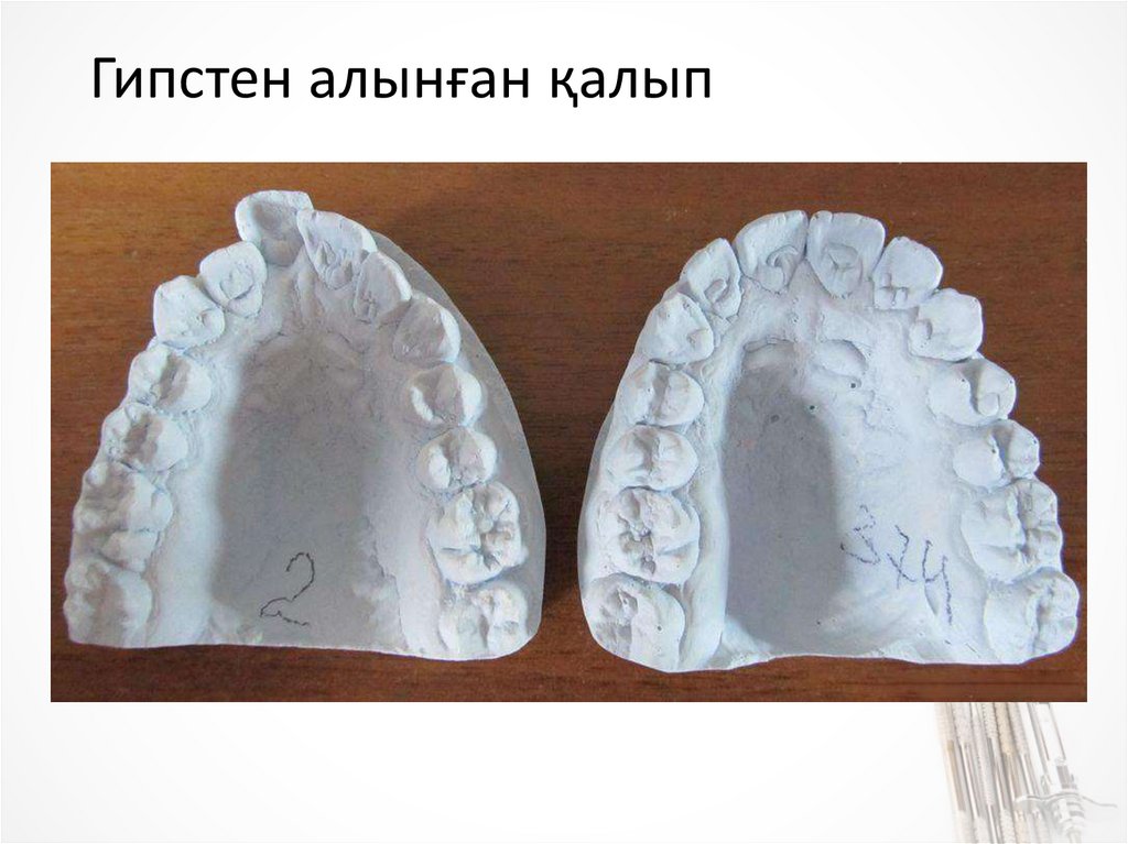 Оттиск в стоматологии. Слепок верхней челюсти. Гипсовые слепки зубов криминалистика. Гипсовый слепок верхней челюсти. Оттиск зубов.