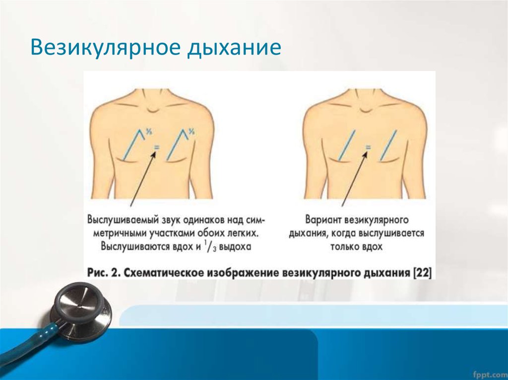 Везикулярное дыхание схема