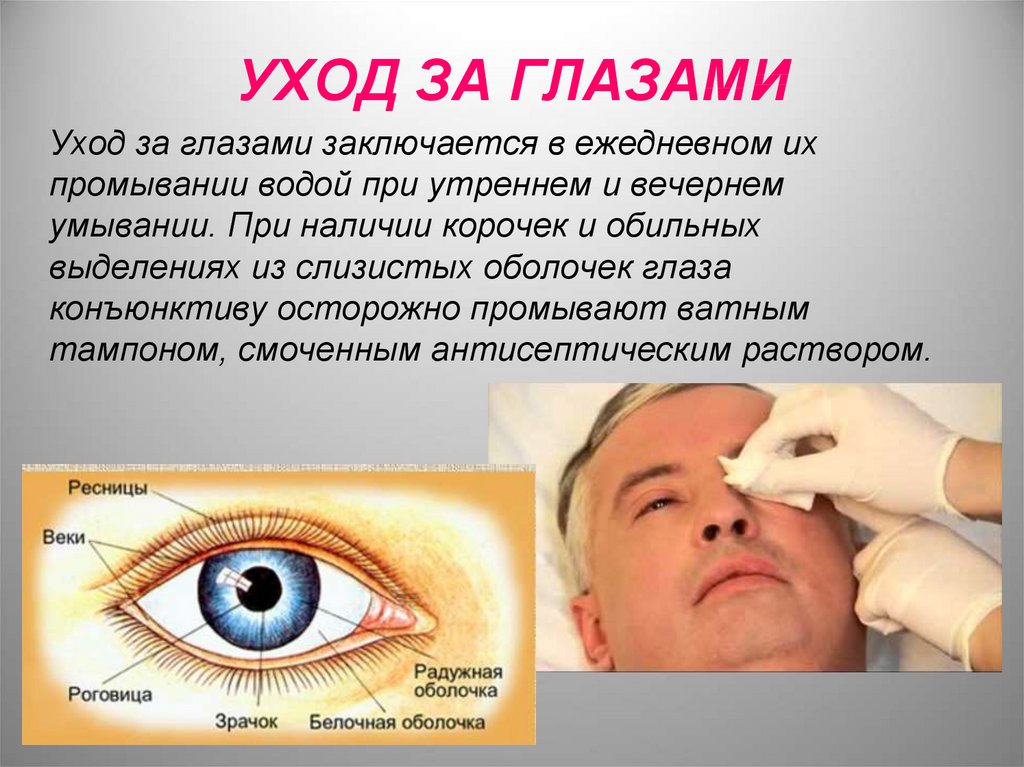 Чем обрабатывают глазки. Уход за глазами тяжелобольного пациента. Гигиена глаз памятка. Обработка глаз тяжелобольного пациента. Уход за глазами пациента алгоритм.