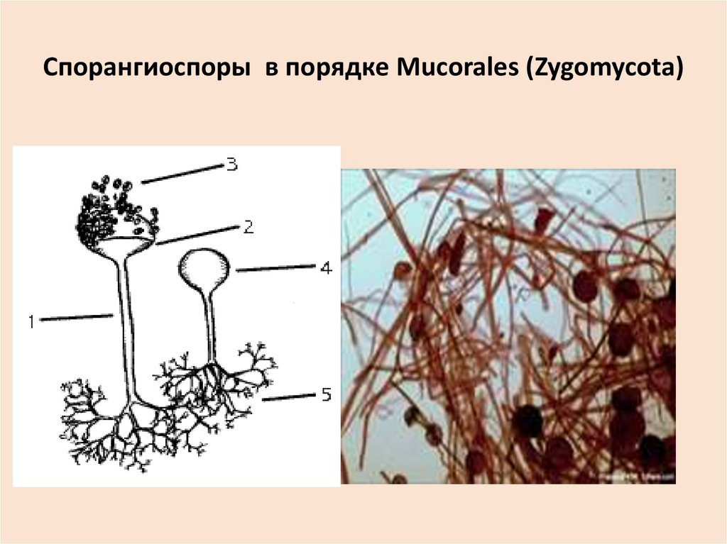 Мукор клетка. Мукор ризопус. Mucorales – мукоралес. Спорангиоспоры и конидии. Спорангиоспоры грибов.