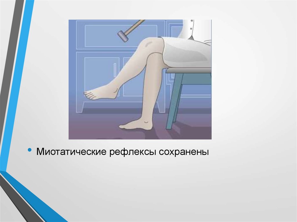 физиологические рефлексы новорожденного таблица. назовите безусловные рефлексы. миотатический и обратный миотатические рефлексы. условные и безусловные рефлексы новорожденных. миотатические рефлексы физиология.