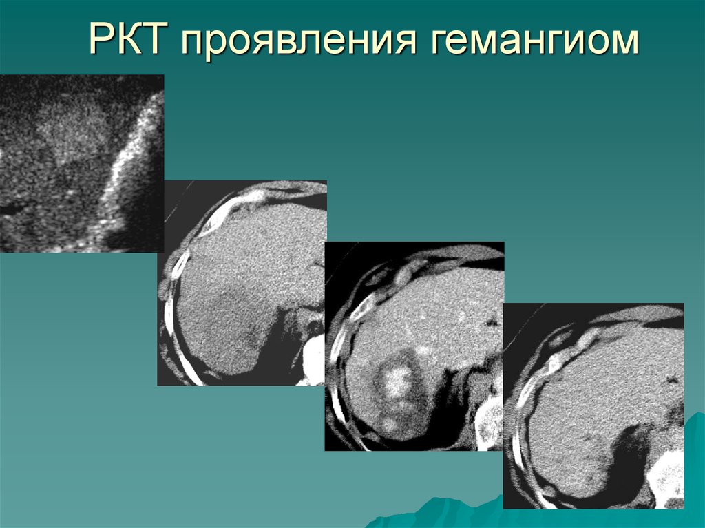 Кт характеристика метода. Свойства кт. Хондробластома кт характеристики.