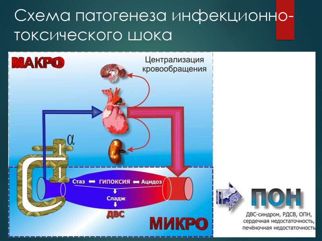 Инфекционно токсический шок презентация