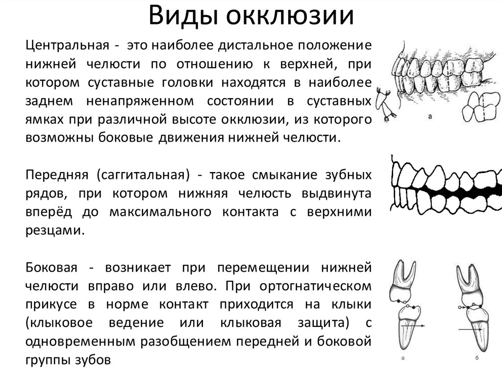 Основы окклюзионной диагностики презентация