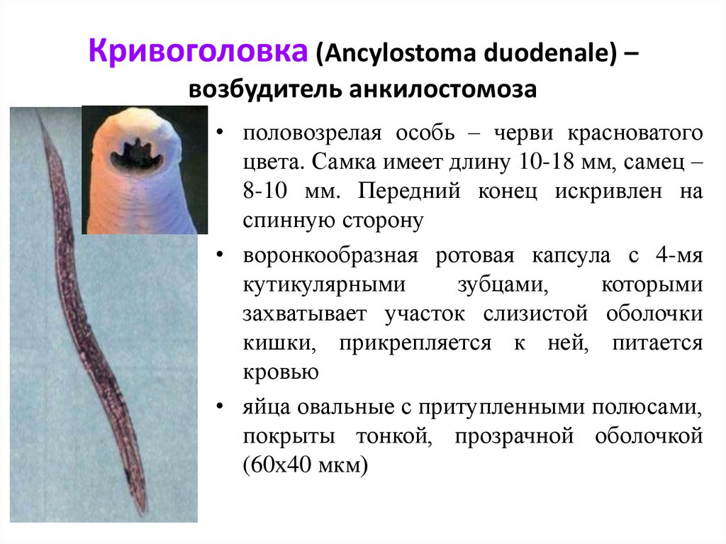 Круглые черви заболевания. Кривоголовка паразитология. Кривоголовка самка и самец. Анкилостома (кривоголовка )(Ancylostoma duodenale).