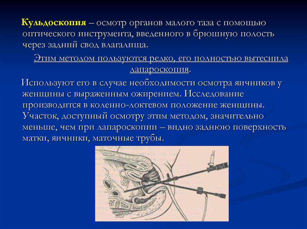 Методы исследования гинекологических больных презентация