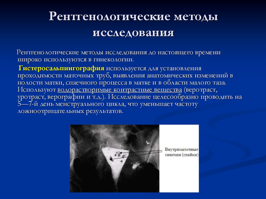 Негативное изображение во время проведения рентгенологического метода исследования образуется при