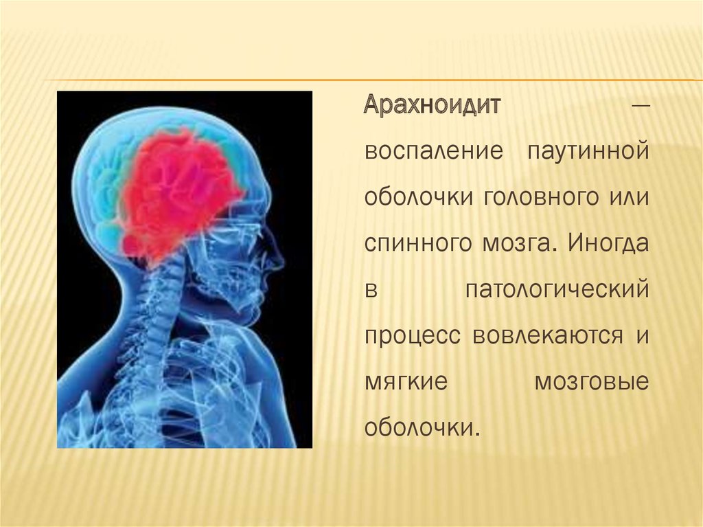 Воспаление головного мозга латынь. Воспаление паутинной мозговой оболочки. Базилярный арахноидит. Кистозный арахноидит. Церебральный арахноидит.