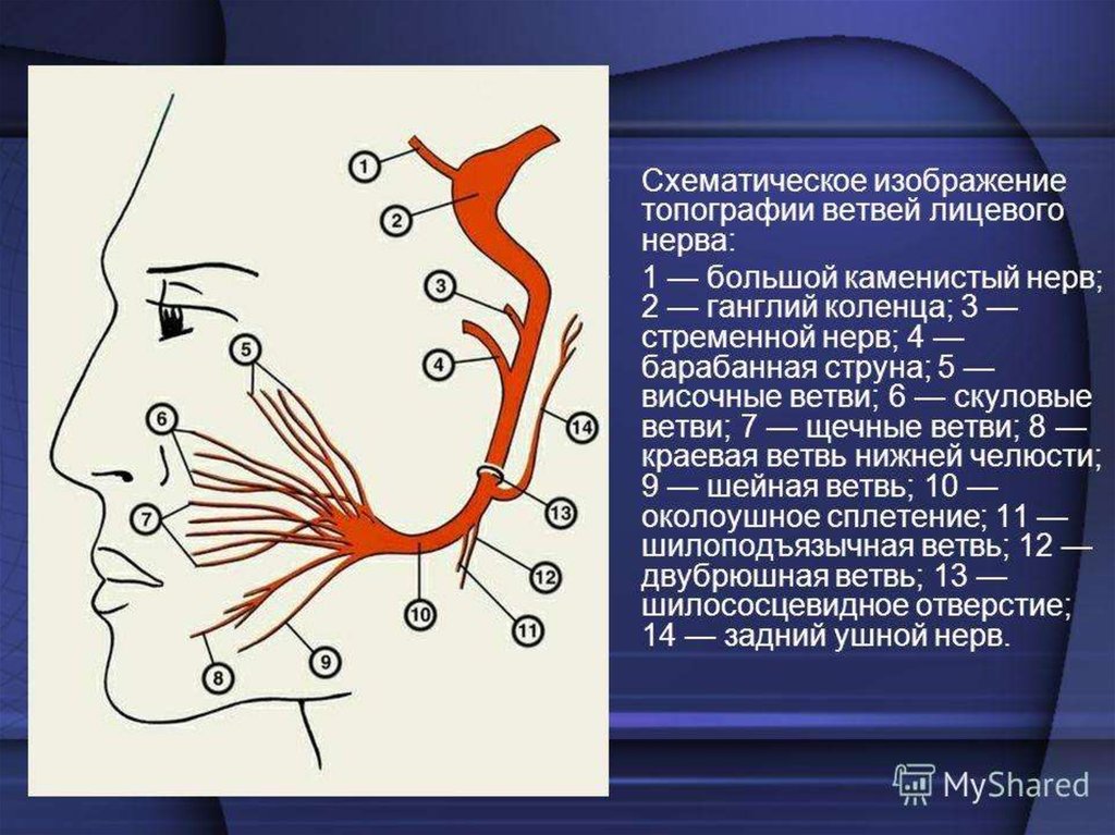3 лицевой нерв. Гусиная лапка лицевого нерва. Ветви лицевого нерва схема. Топография ветвей тройничного нерва. Лицевой нерв анатомия топография ветви.