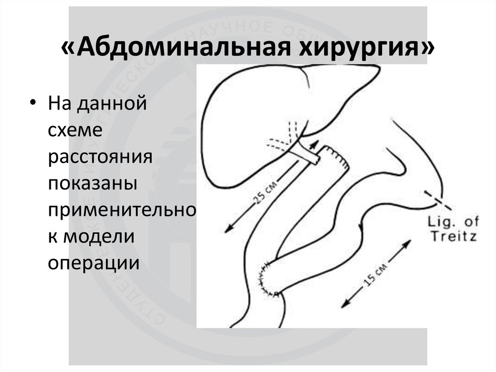 «Абдоминальная хирургия»