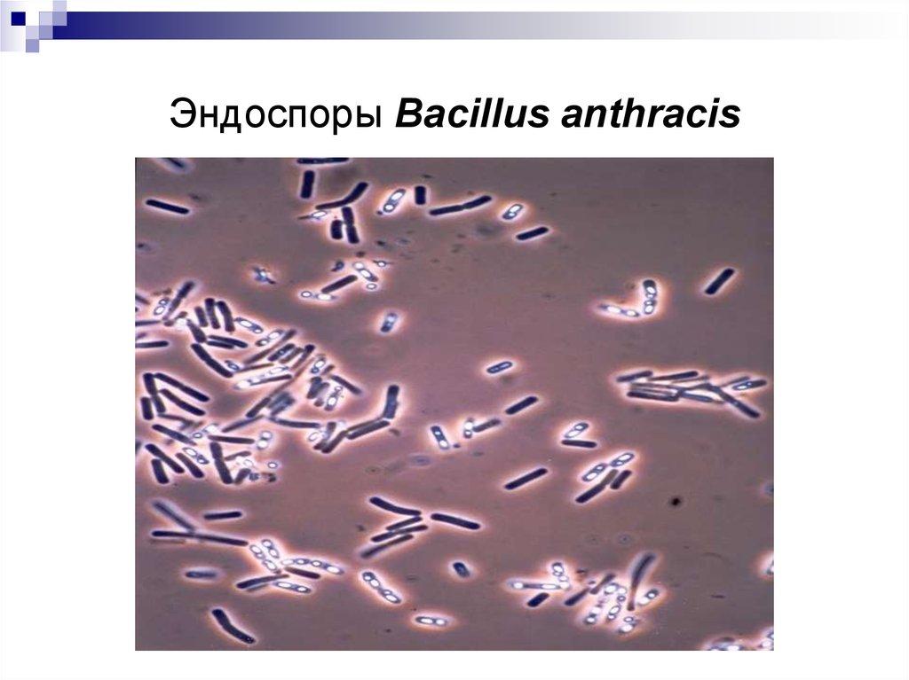 Эндоспоры Bacillus anthracis