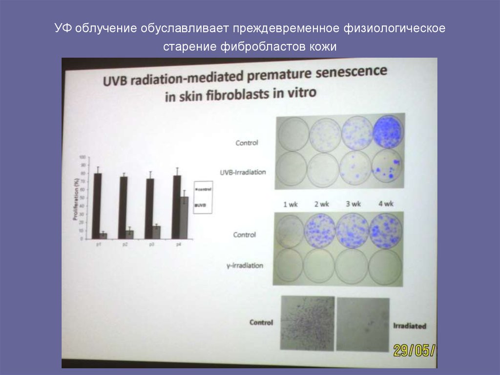 УФ облучение обуславливает преждевременное физиологическое старение фибробластов кожи