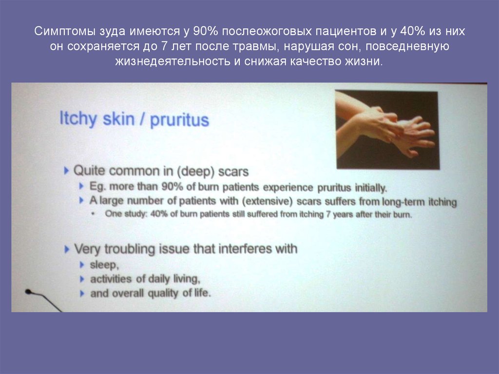 Симптомы зуда имеются у 90% послеожоговых пациентов и у 40% из них он сохраняется до 7 лет после травмы, нарушая сон,