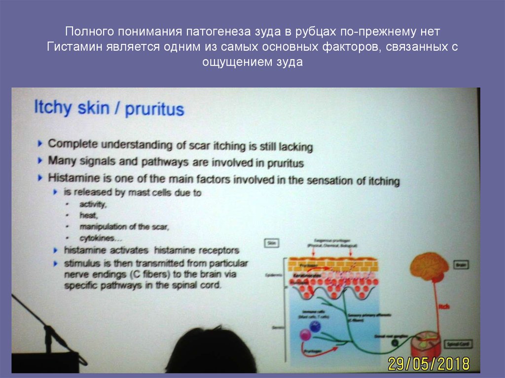 Полного понимания патогенеза зуда в рубцах по-прежнему нет Гистамин является одним из самых основных факторов, связанных с