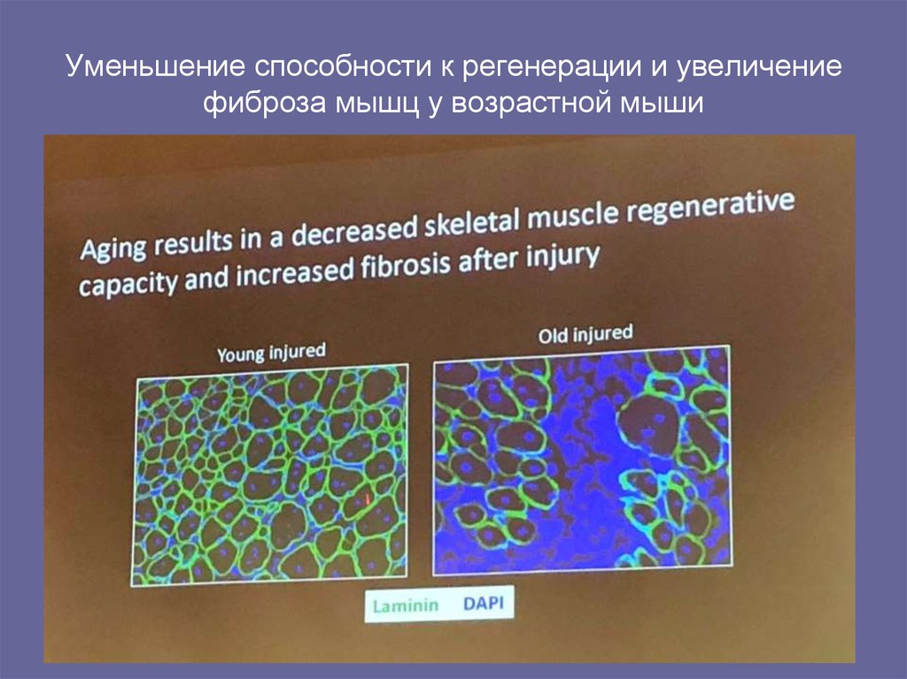 Уменьшение способности к регенерации и увеличение фиброза мышц у возрастной мыши