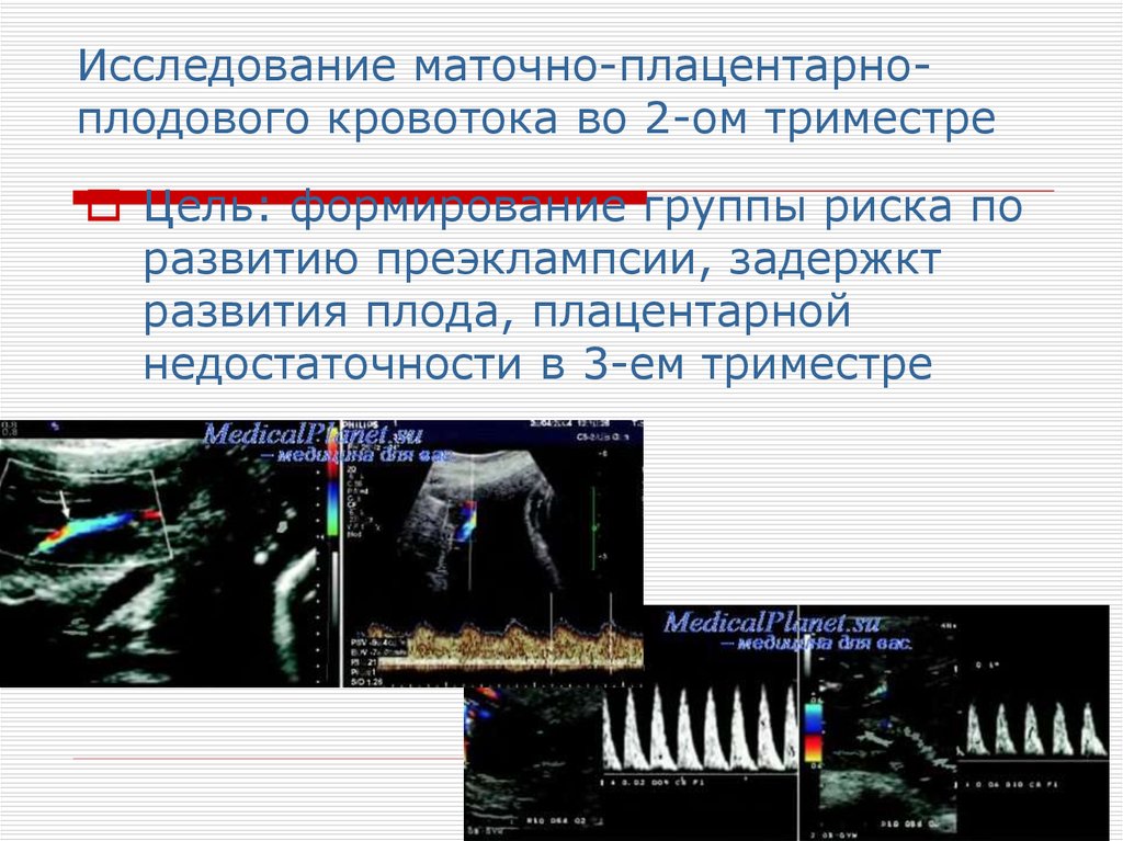 Нарушения маточно плацентарного плодового кровотока. Плацентарный кровоток. Маточно плодово плацентарный кровоток. Плацентарное кровообращение. Пренатальная диагностика.