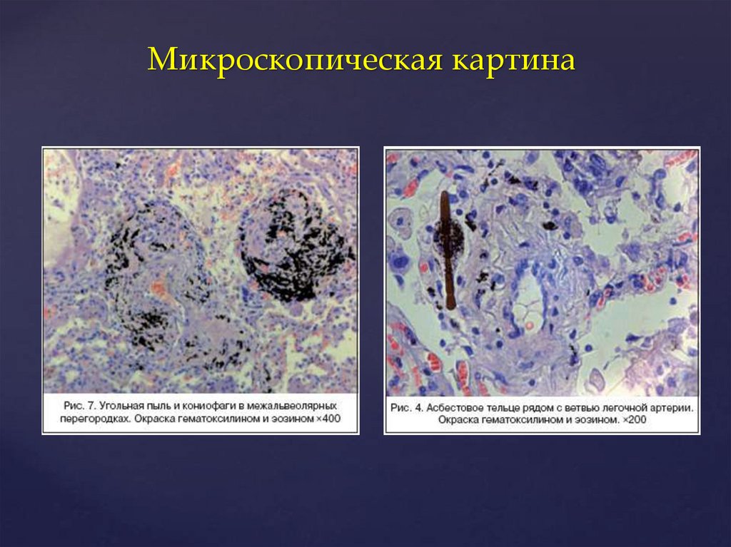 Микроскопическая картина u норма