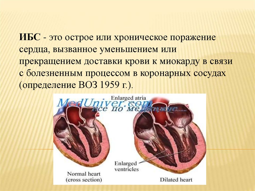 Ишемическая кардиомиопатия причины. Классификация ИБС. Классификация ИБС по воз. ИБС этиология картинки.