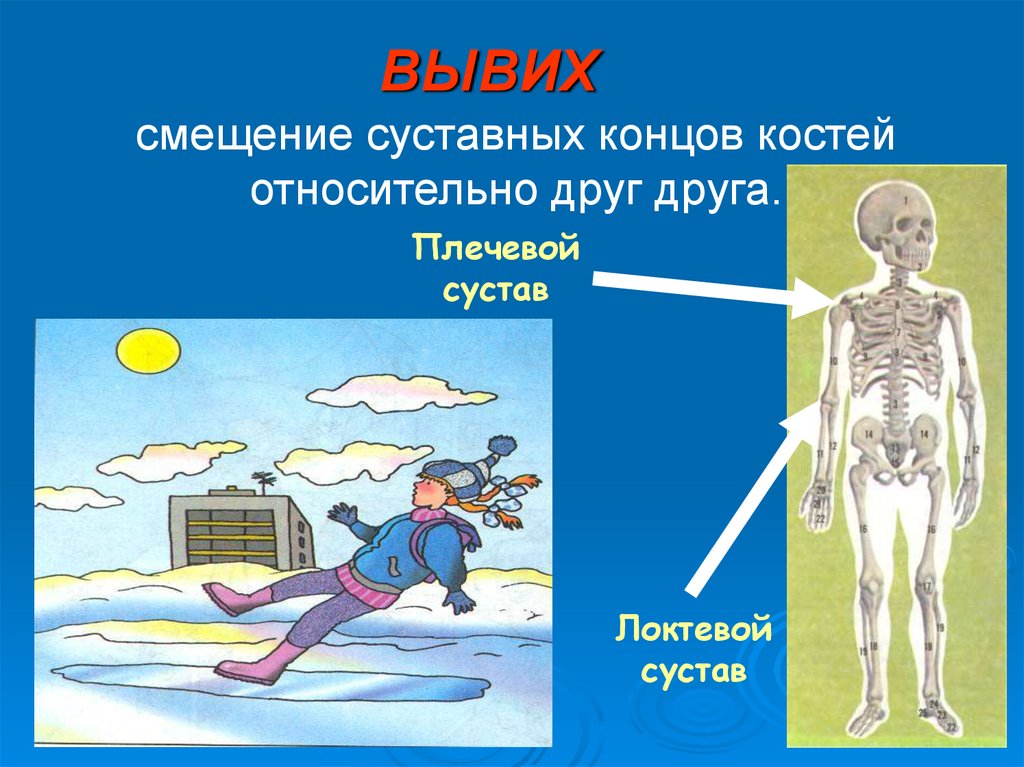 Конец кости. Травмы различных областей тела презентация. Смещение суставных концов костей. Закрытые травмы различных областей тела,. Травмы картинки для презентации.