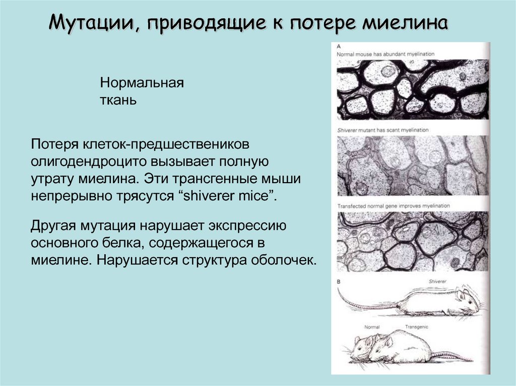 Нормальная ткань. Белки миелина. Клетки которые синтезируют белки миелина. Протеолипидный белок миелина. Потеря миелина причины.